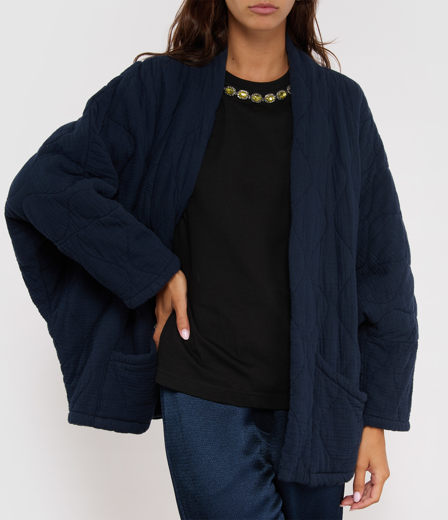 Chicago Night Jacket